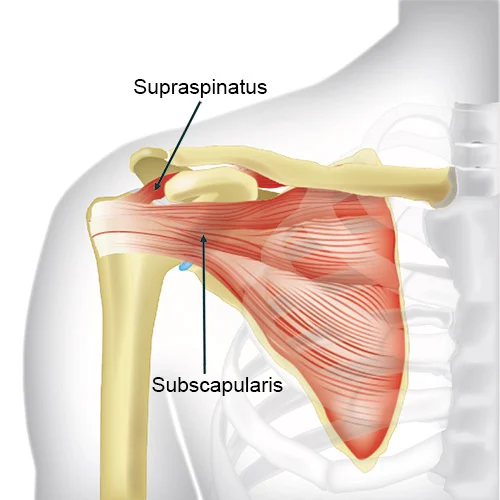 shoulder anterior subscapularis supraspinatus